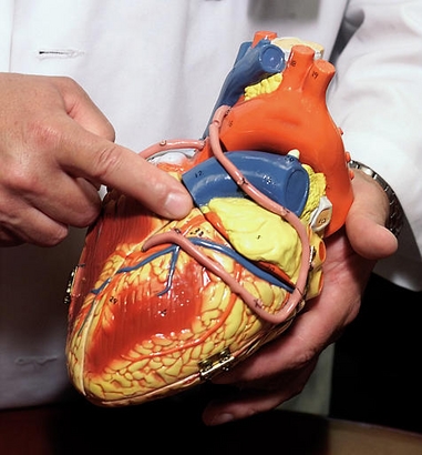 In this file photo, Dr. John Lasala, director of the Cardiac Cath Lab at Barnes-Jewish Hospital, points out one of the three major coronary arteries, the one he ominously refers to as the 'widowmaker,' using a model of the human heart, June 24, 2002 in St. Louis. The pink tubes on the model depict a heart after bypass surgery. (AP Photo/Tom Gannam)