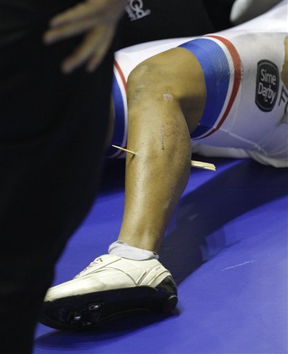 A splinter is seen through the leg of Malaysia's Azizulhasni Awang after a crash in the Men's Keirin Final during the Track Cycling World Cup at the National Cycling Centre, Manchester, England, Saturday Feb. 19, 2011. Awang finished third in the race.