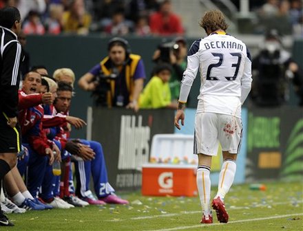 Members Of FC Dallas, Left, Point To The Blood On Los Angeles Galaxy Midfielder David Beckham's Jersey